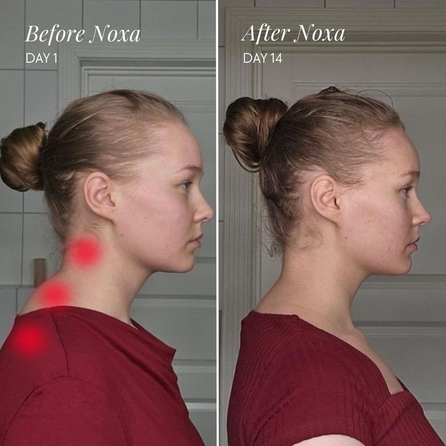 BloomCare™ Noxa Neck and Shoulder Massager